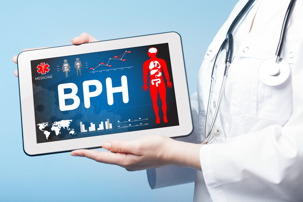 BPH Could Lead to ED