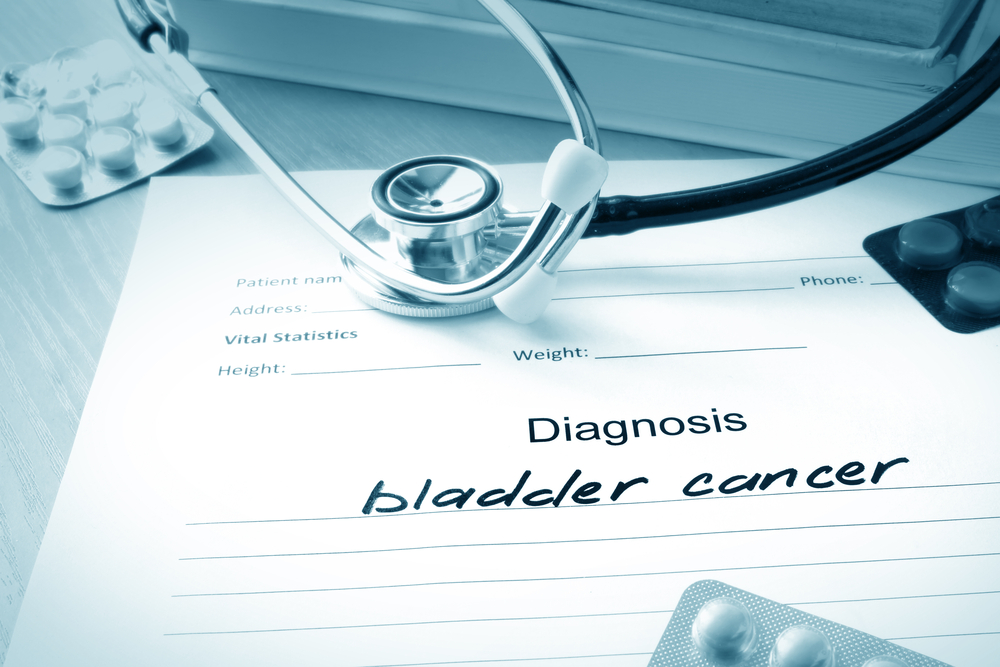 Clinicians Can Now Personalize Bladder Cancer Treatment